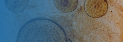 Fillers/Acido Hialuronico/Preenchimento